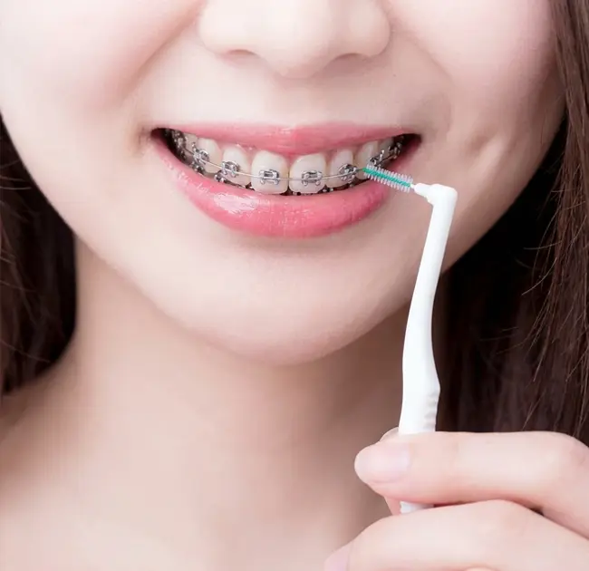 Sikat Interdental Ciptakan Pengalaman Baru Perawatan Mulut yang Sempurna